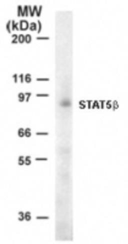 Western Blot: STAT5B Antibody [NB100-56324] - Analysis of Stat5b in 10 ug of Jurkat cell lysate using 1 ug/ml this antibody. Immunoreaction was detected by chemiluminescence