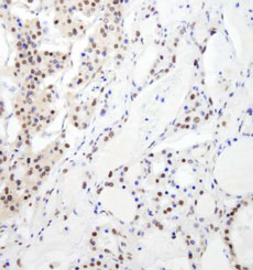 Detection of human RBM26 by immunohistochemistry.