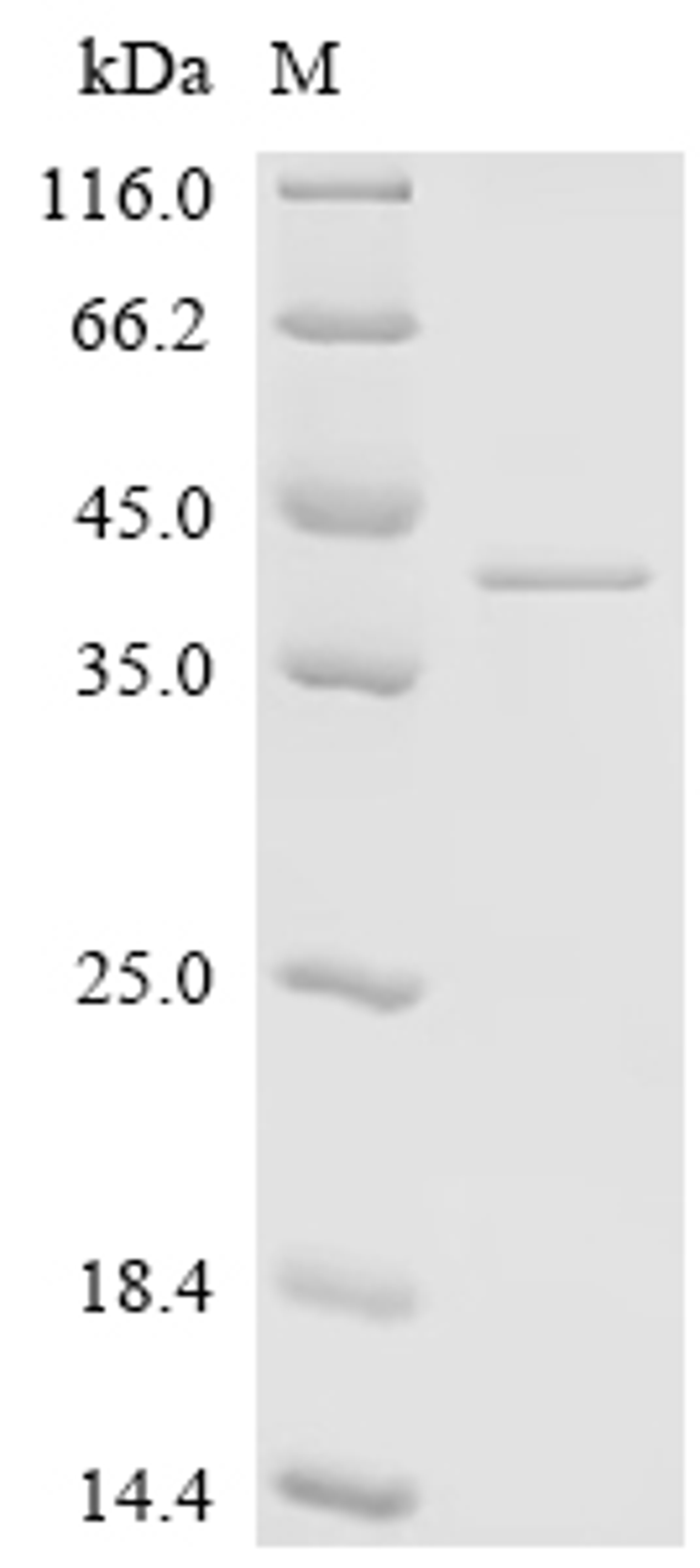 (Tris-Glycine gel) Discontinuous SDS-PAGE (reduced) with 5% enrichment gel and 15% separation gel.