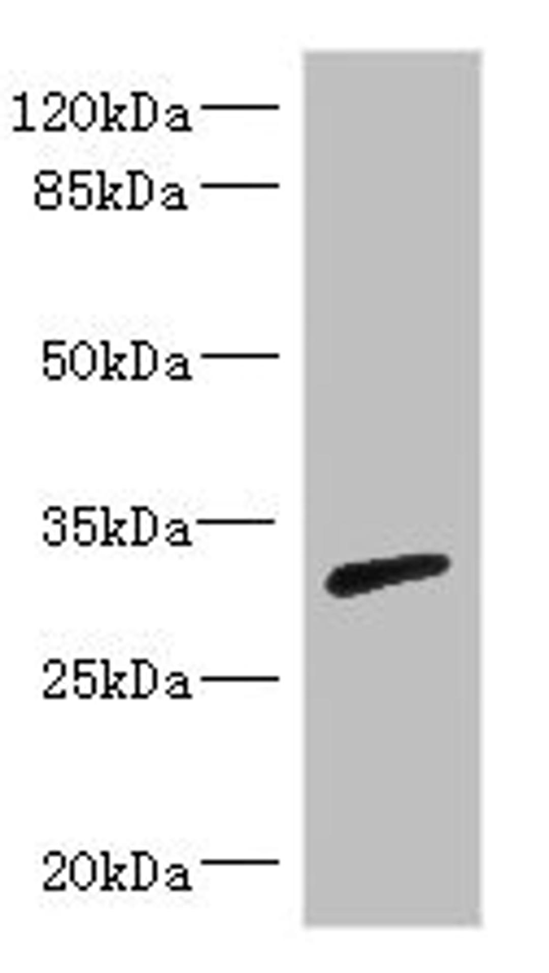 Western blot. All lanes: RPIA antibody IgG at 3.29ug/ml + Mouse kidney tissue. Secondary. Goat polyclonal to rabbit IgG at 1/10000 dilution. Predicted band size: 33 kDa. Observed band size: 33 kDa. 