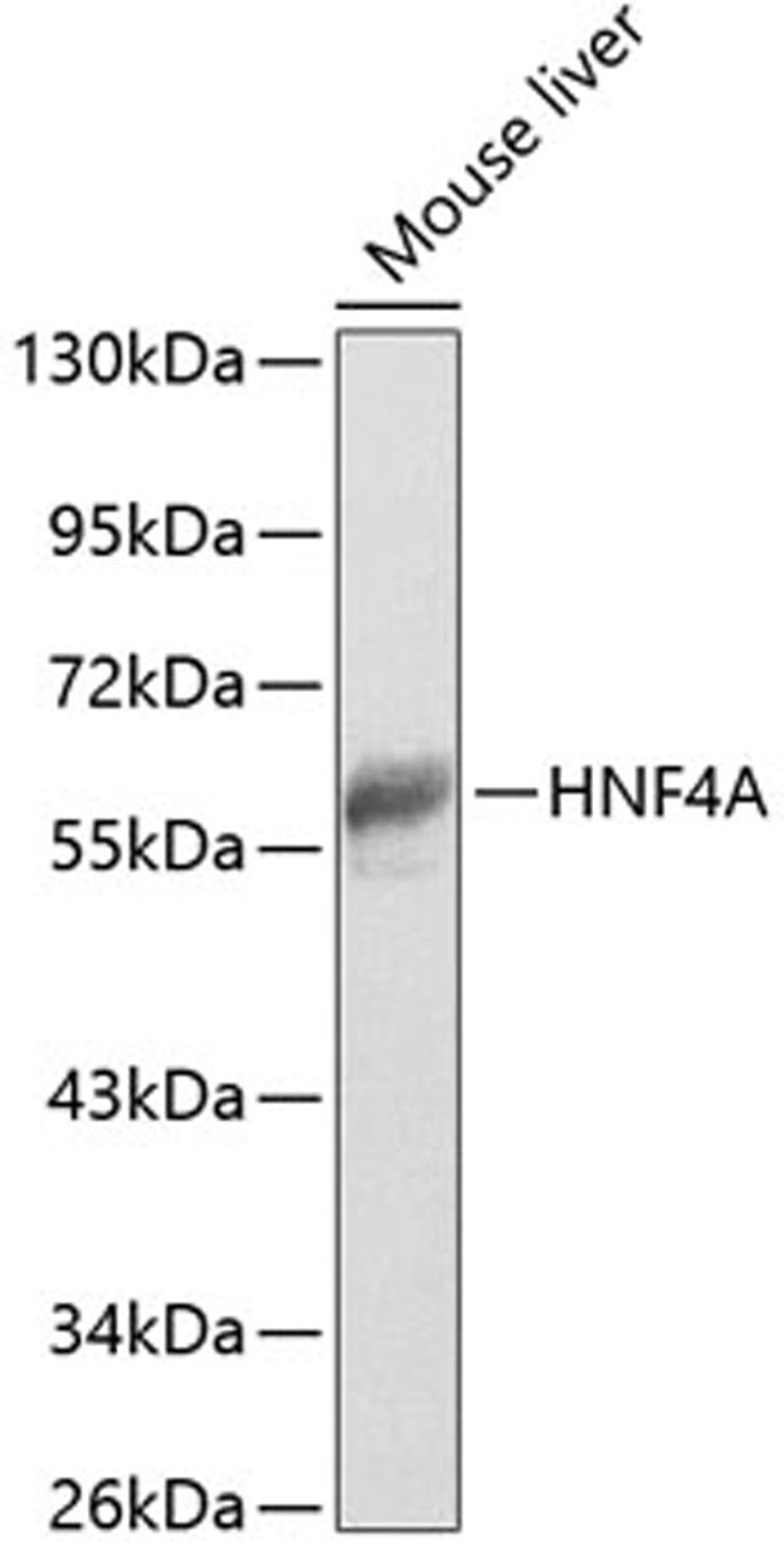 Western blot - HNF4A antibody (A13998)