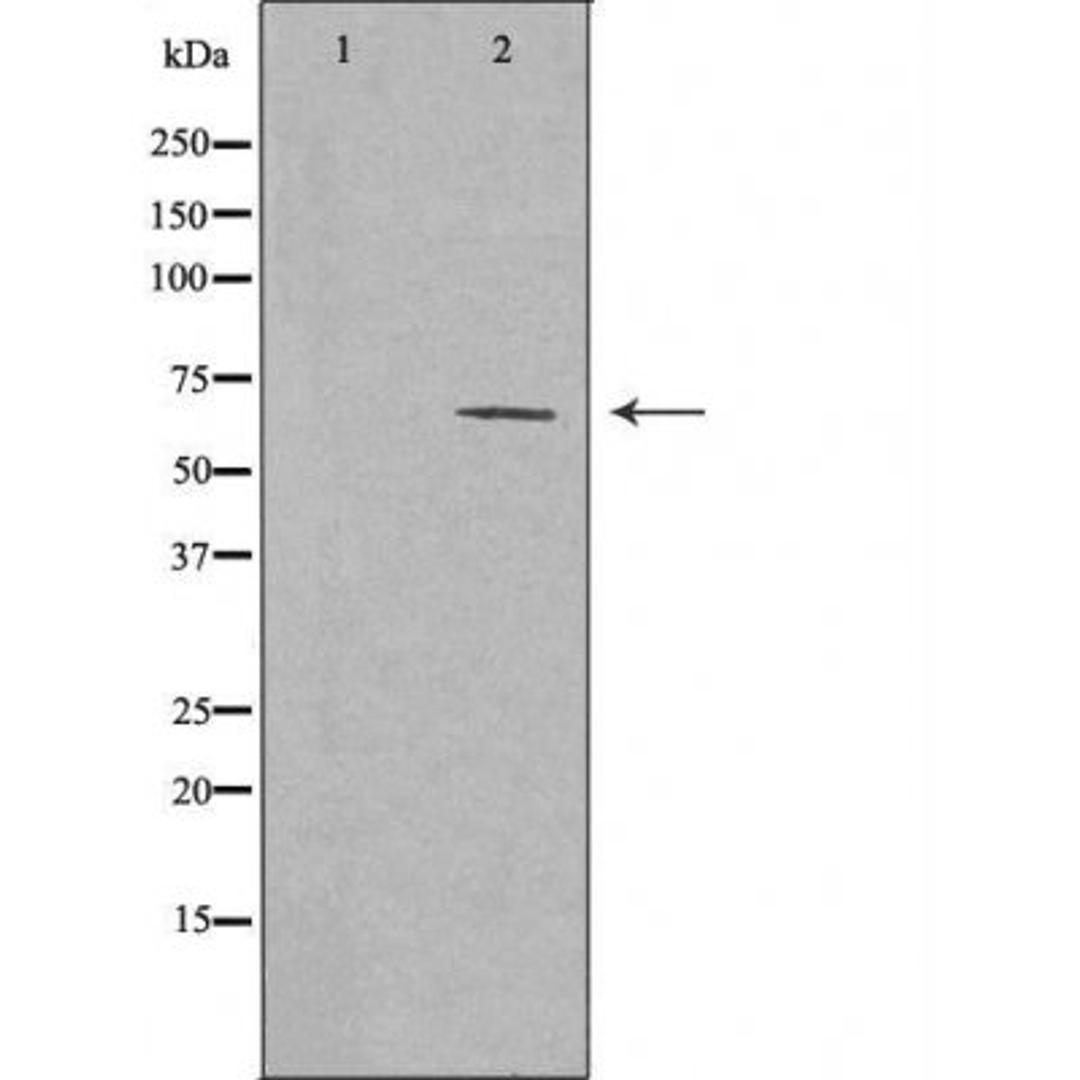 Western blot analysis of Jurkat cells and A549 cells using Collagen XXV Alpha1 antibody