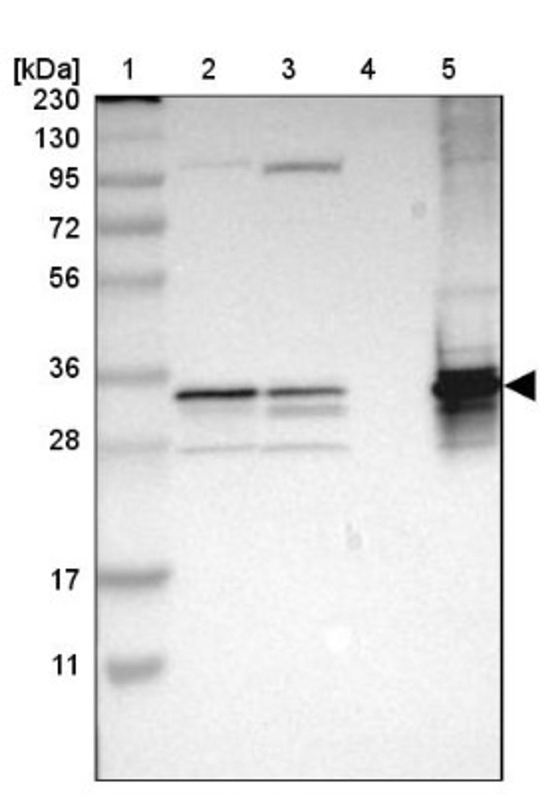 Western Blot: TST Antibody [NBP1-87147] - Lane 1: Marker [kDa] 230, 130, 95, 72, 56, 36, 28, 17, 11<br/>Lane 2: Human cell line RT-4<br/>Lane 3: Human cell line U-251MG sp<br/>Lane 4: Human plasma (IgG/HSA depleted)<br/>Lane 5: Human liver tissue