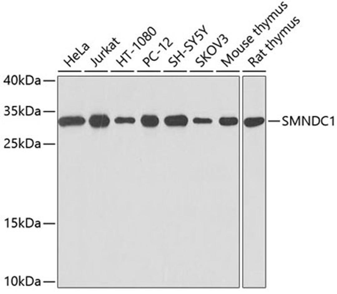 Western blot - SMNDC1 antibody (A0681)