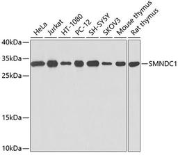 Western blot - SMNDC1 antibody (A0681)