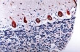 Immunohistochemistry: Caspase 6 Antibody [NB100-56114] - Formalin-fixed paraffin-embedded tissue section of dog cerebellum stained for Caspase-6 expression at 1:2000. Hematoxylin-eosin counterstain.