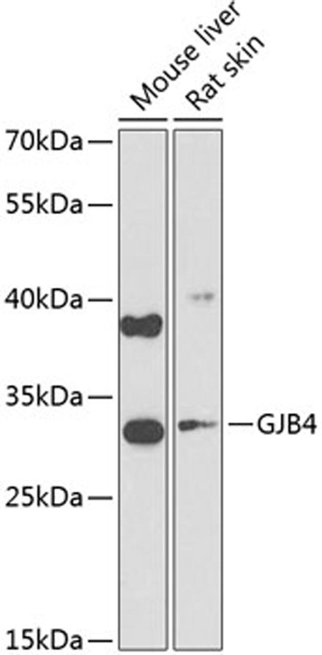 Western blot - GJB4 Antibody (A9888)