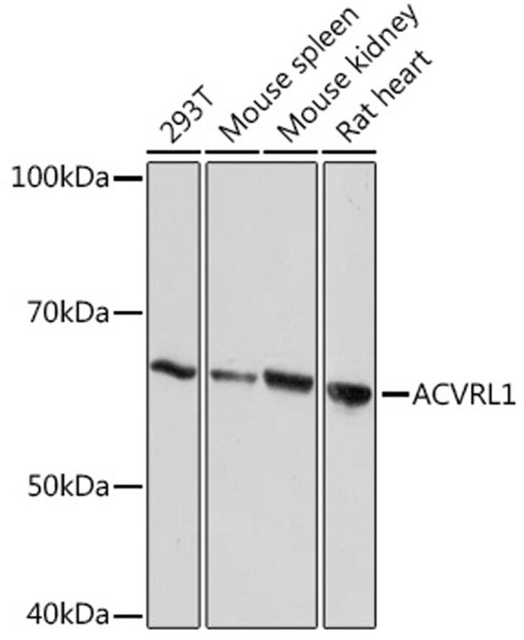 Western blot - ACVRL1 Rabbit mAb (A9755)