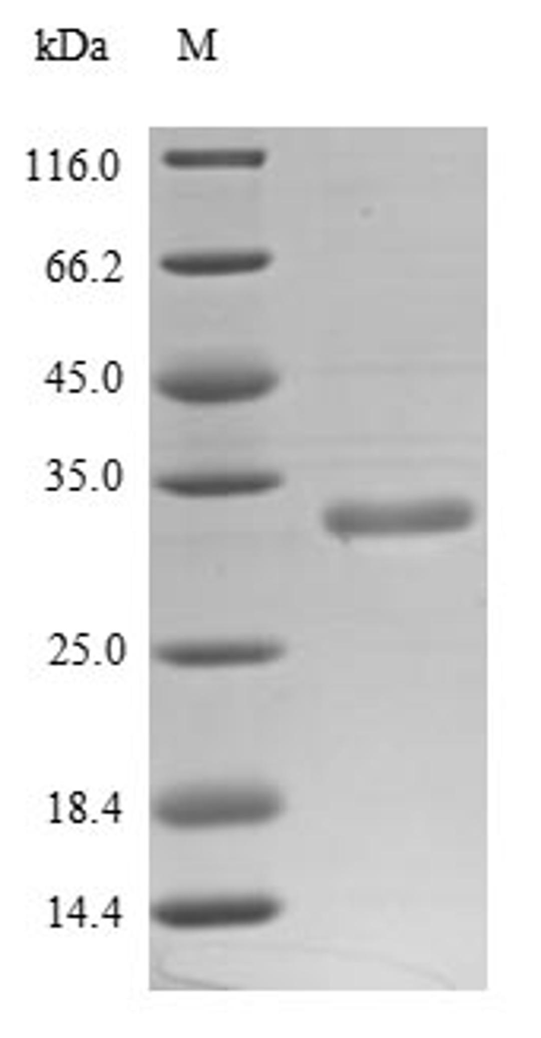 (Tris-Glycine gel) Discontinuous SDS-PAGE (reduced) with 5% enrichment gel and 15% separation gel.