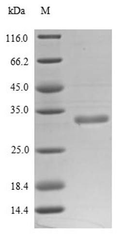 (Tris-Glycine gel) Discontinuous SDS-PAGE (reduced) with 5% enrichment gel and 15% separation gel.