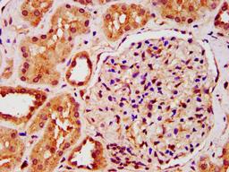 IHC image of CSB-PA012171LA01HU diluted at 1:200 and staining in paraffin-embedded human kidney tissue performed on a Leica BondTM system. After dewaxing and hydration, antigen retrieval was mediated by high pressure in a citrate buffer (pH 6.0). Section was blocked with 10% normal goat serum 30min at RT. Then primary antibody (1% BSA) was incubated at 4&deg;C overnight. The primary is detected by a biotinylated secondary antibody and visualized using an HRP conjugated SP system.