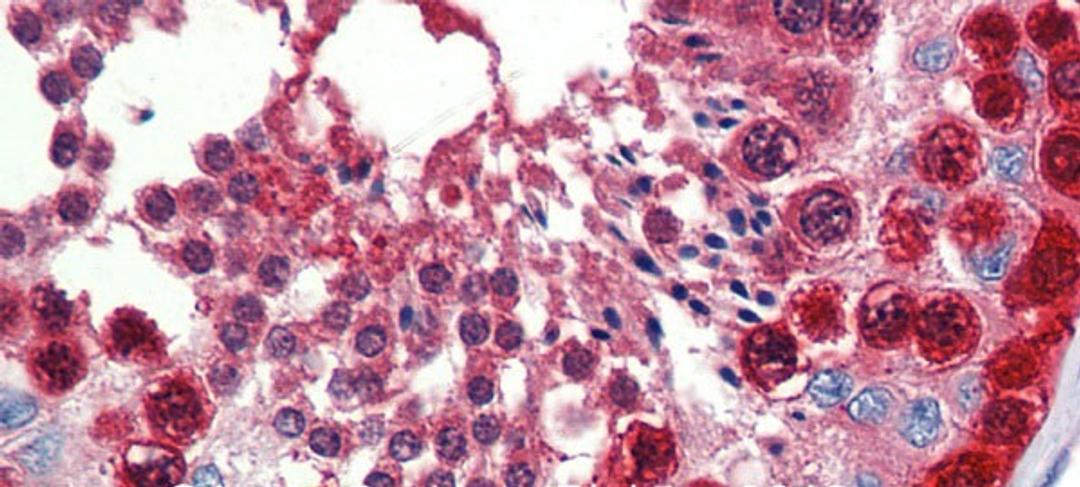 Antibody used in IHC on Human Testis at 5.0 ug/ml.