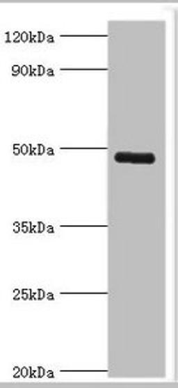 Western blot analysis of human serum using KCNN4 antibody