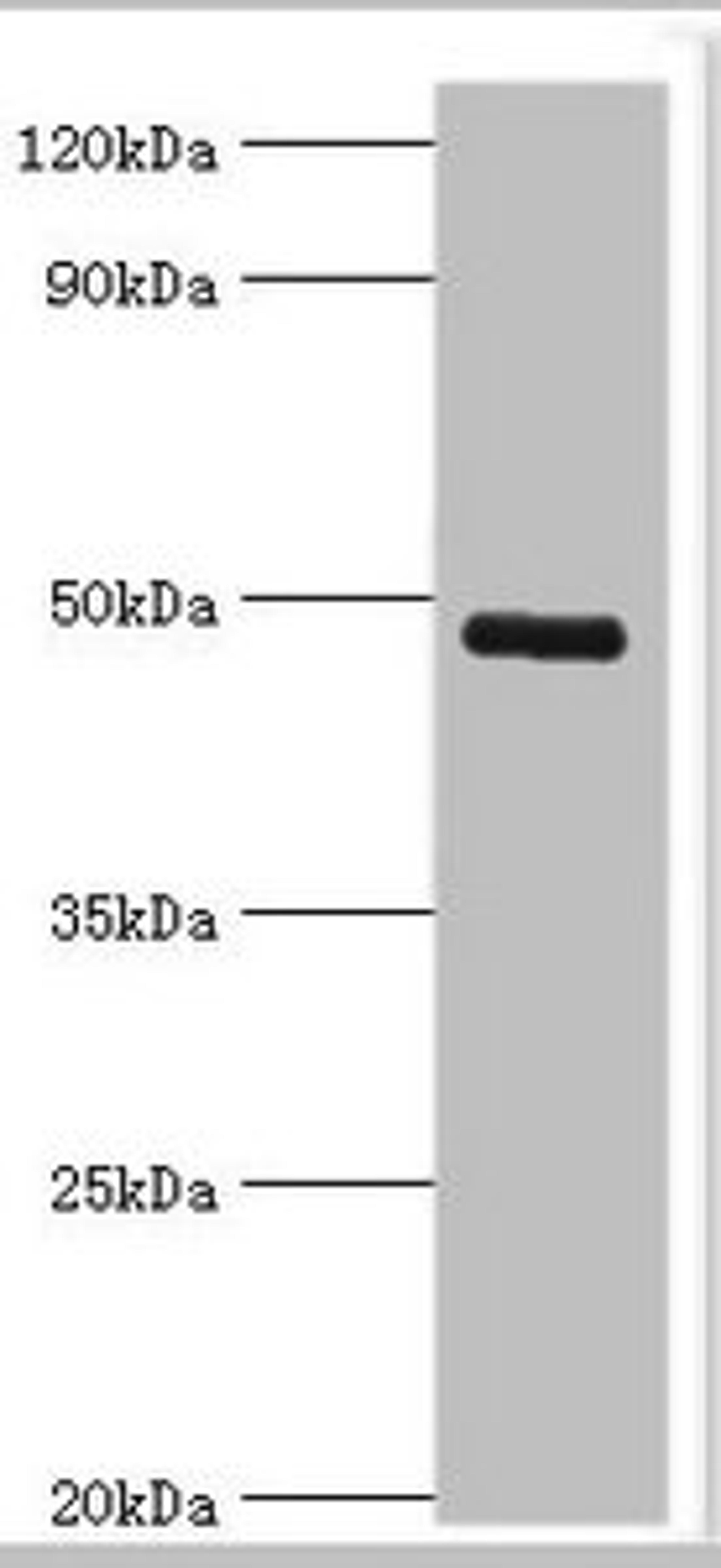 Western blot analysis of human serum using KCNN4 antibody