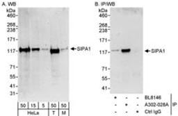 Detection of human and mouse SIPA1 by western blot (h&m) and immunoprecipitation (h).