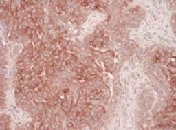 Detection of human Derlin-1 by immunohistochemistry.