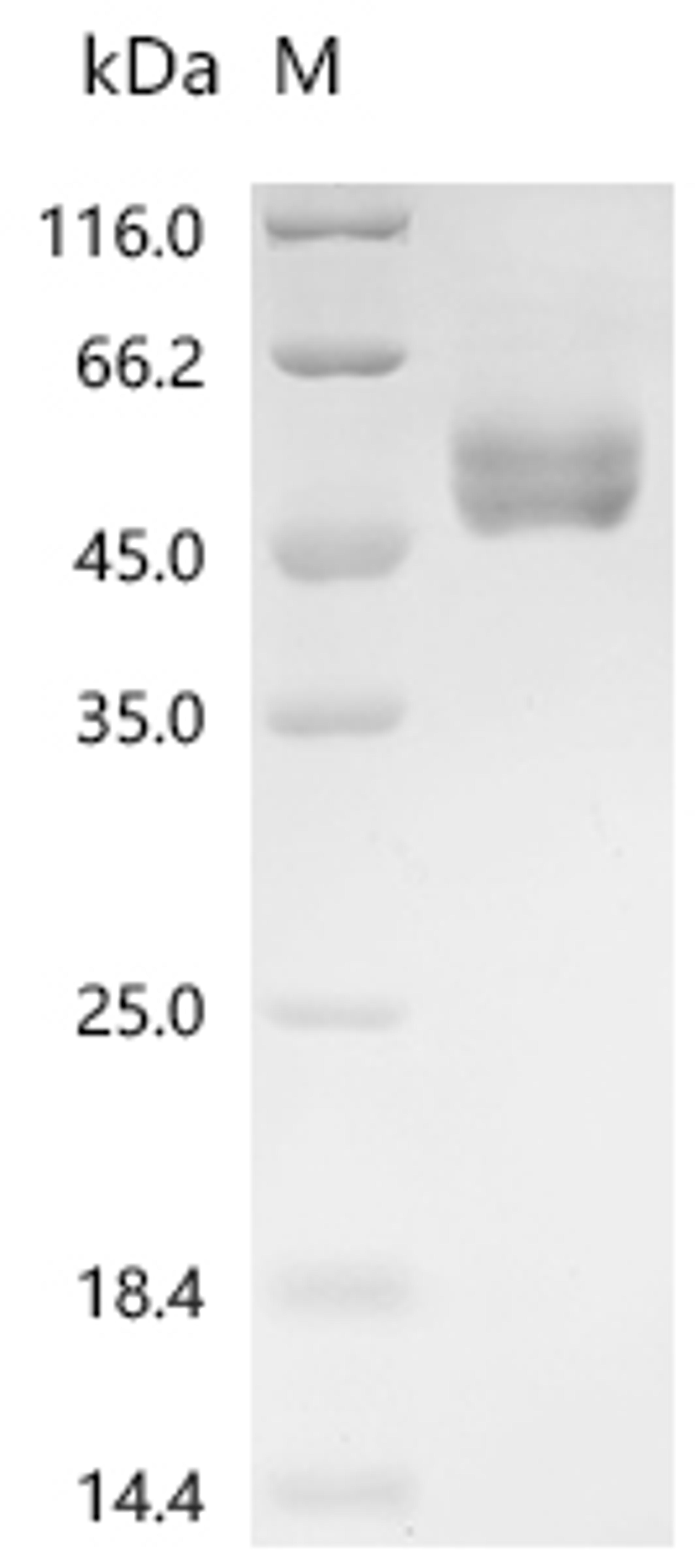 (Tris-Glycine gel) Discontinuous SDS-PAGE (reduced) with 5% enrichment gel and 15% separation gel.