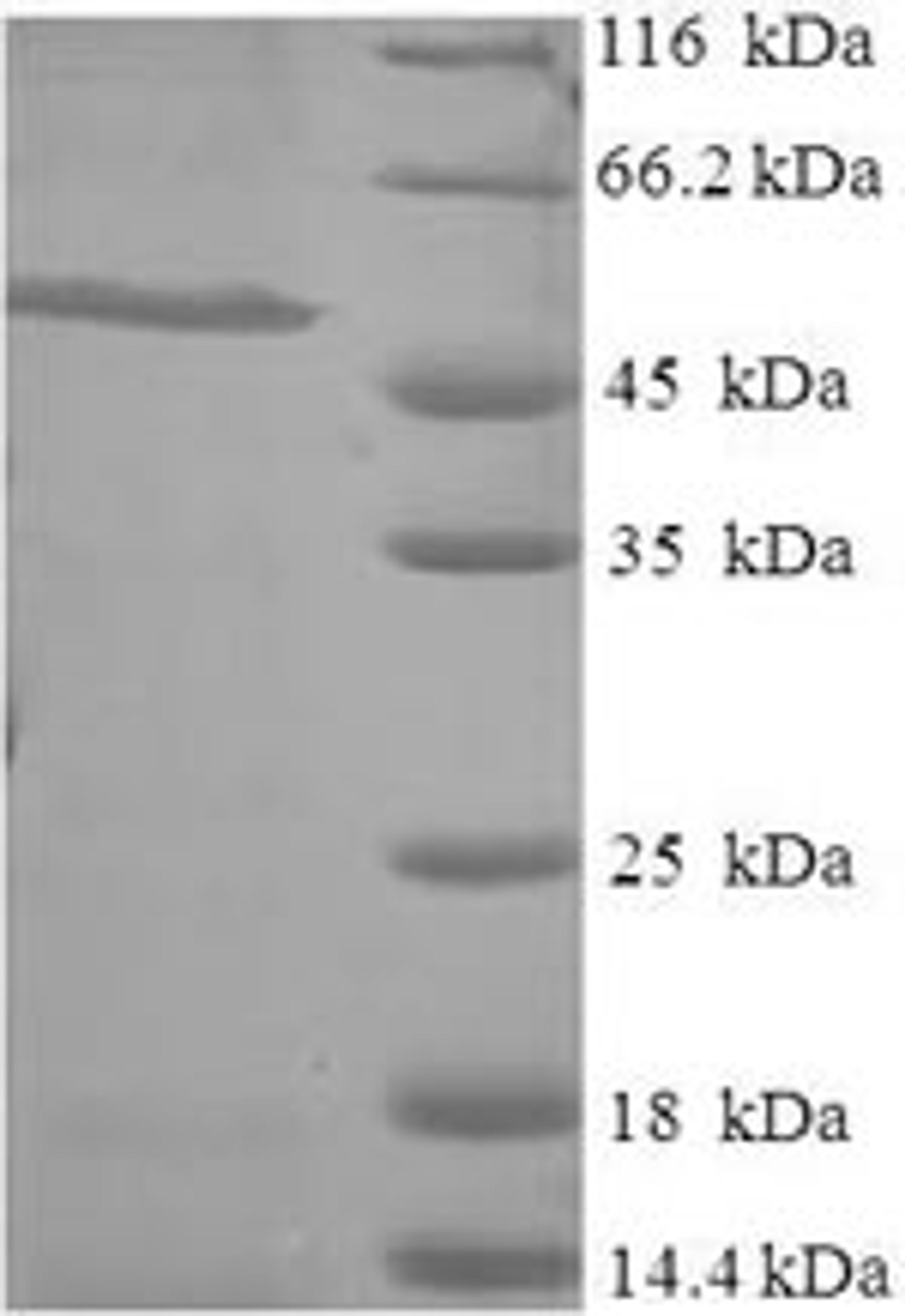 (Tris-Glycine gel) Discontinuous SDS-PAGE (reduced) with 5% enrichment gel and 15% separation gel.