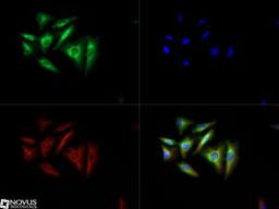 Immunocytochemistry/Immunofluorescence: Torc2 Antibody [NBP2-22356] - Torc2 antibody was tested in Hela cells with DyLight 488 (green). Nuclei and alpha-tubulin were counterstained with DAPI (blue) and Dylight 550 (red).