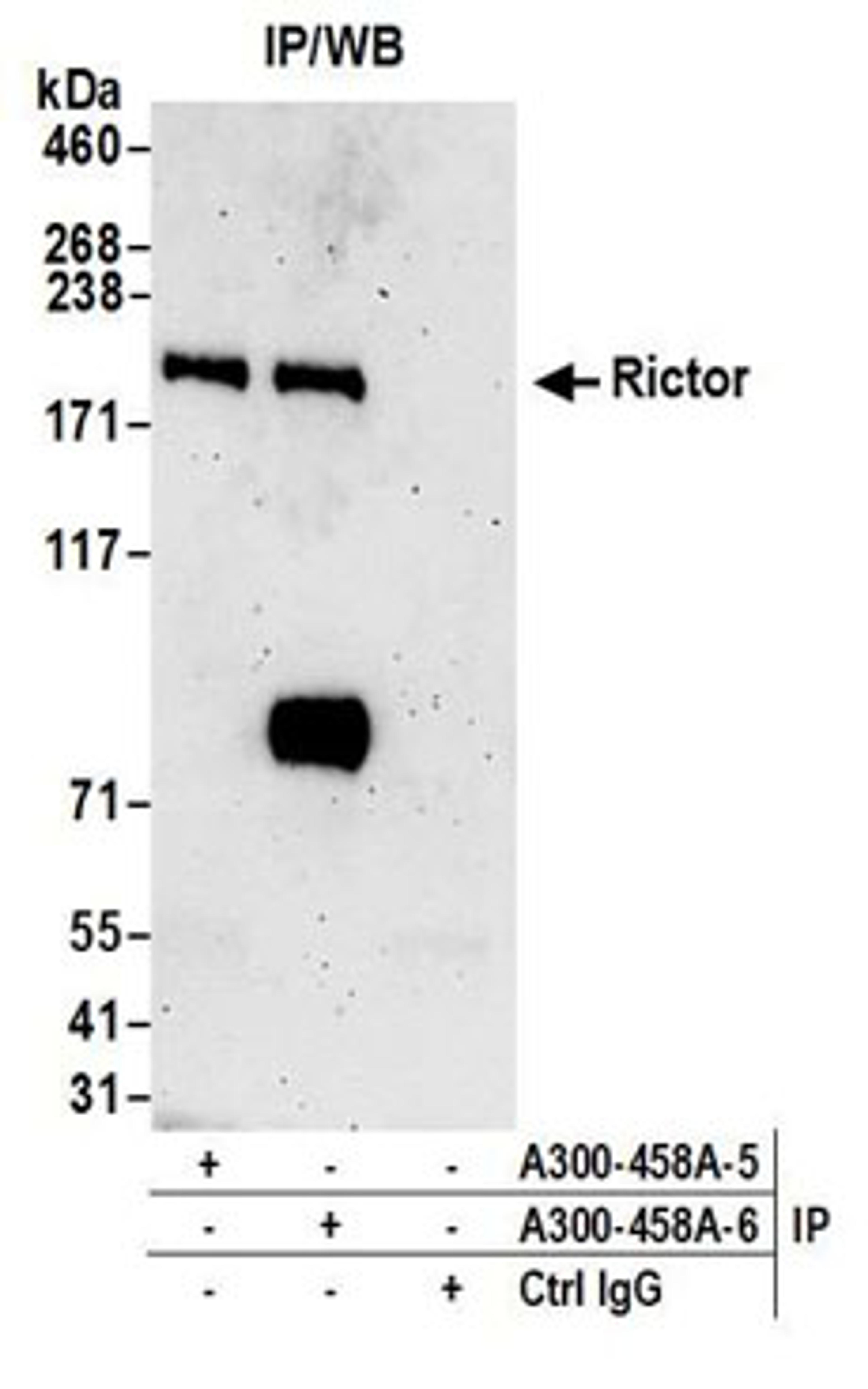 Detection of human Rictor by western blot of immunoprecipitates.