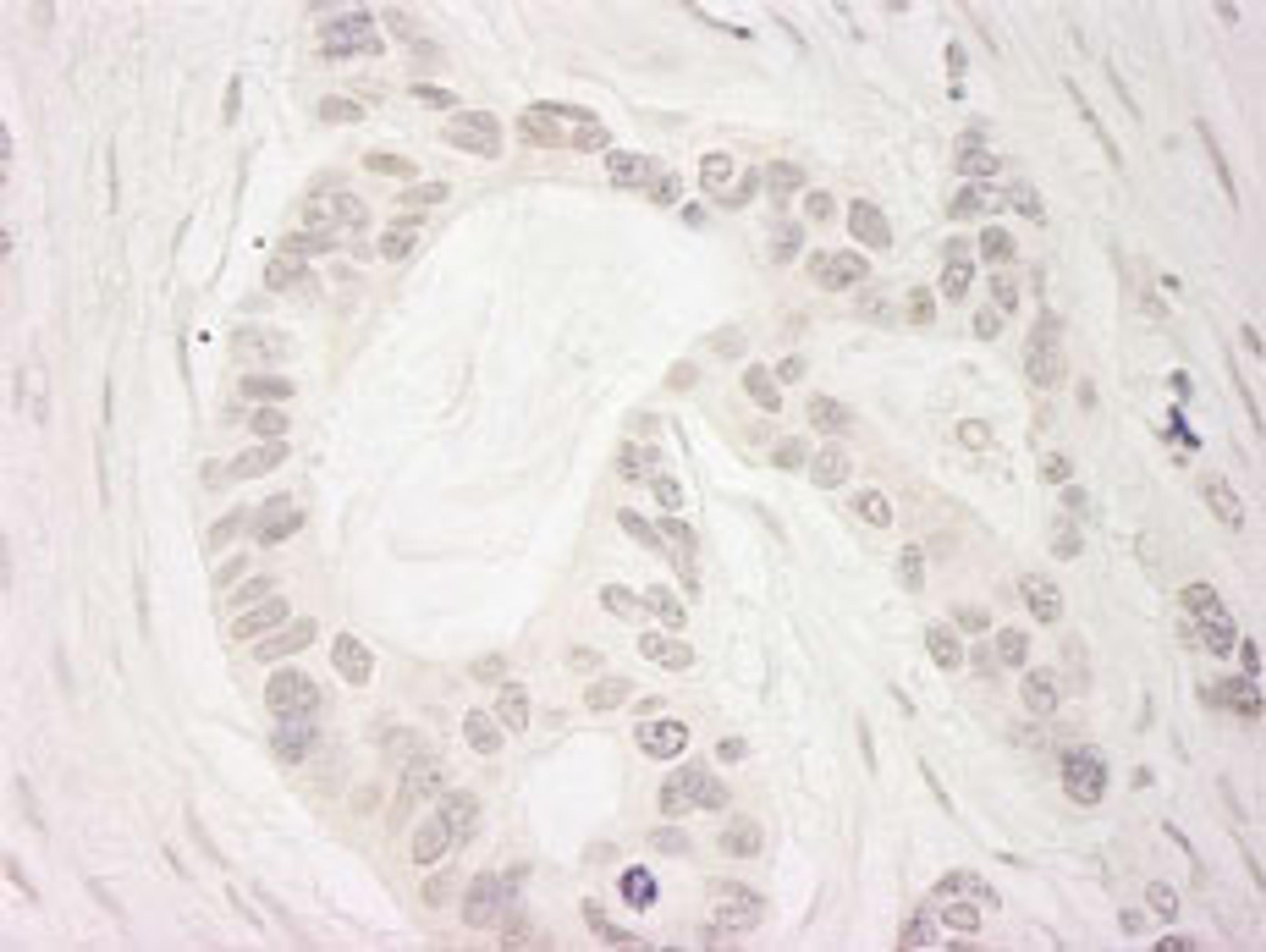 Detection of human BubR1 by immunohistochemistry.