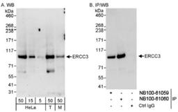 Western Blot: XPB Antibody [NB100-61060] - Detection of Human and Mouse ERCC3 on HeLa whole cell lysate using NB100-61060. ERCC3 was also immunoprecipitated by rabbit anti-ERCC3 antibody NB100-61059.