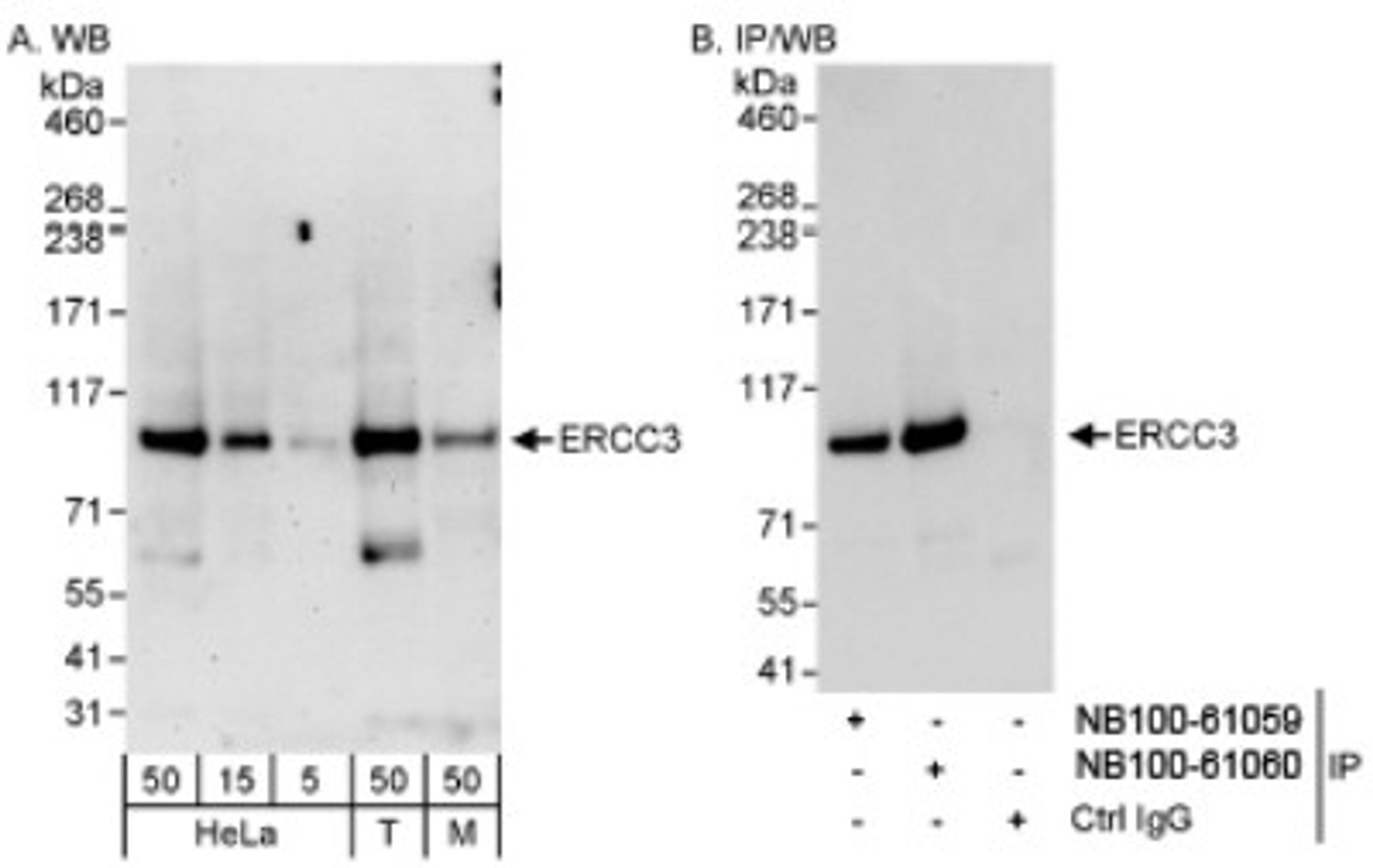 Western Blot: XPB Antibody [NB100-61060] - Detection of Human and Mouse ERCC3 on HeLa whole cell lysate using NB100-61060. ERCC3 was also immunoprecipitated by rabbit anti-ERCC3 antibody NB100-61059.