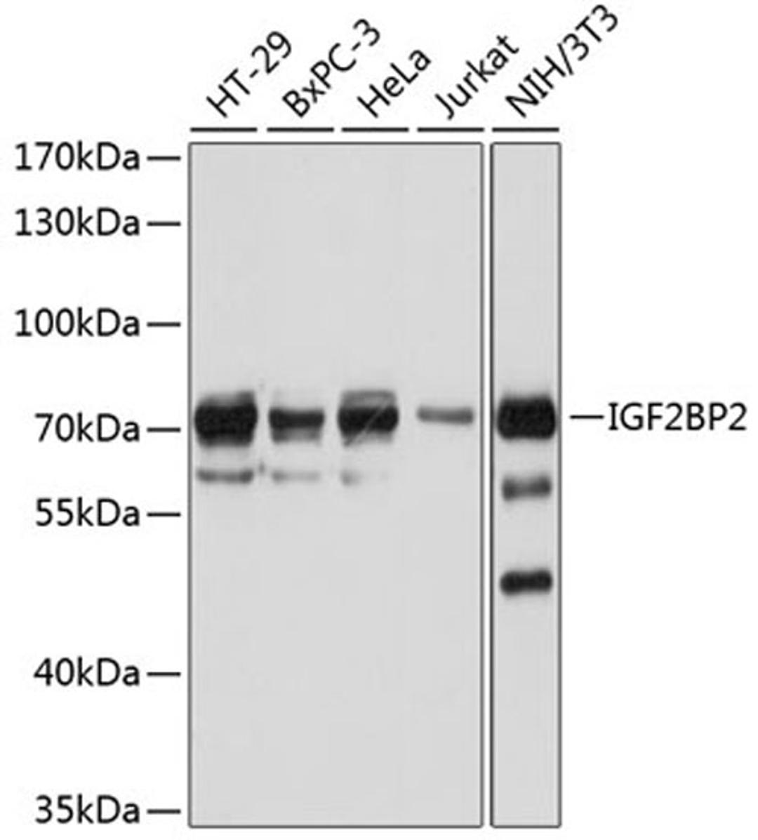 Western blot - IGF2BP2 antibody (A1774)