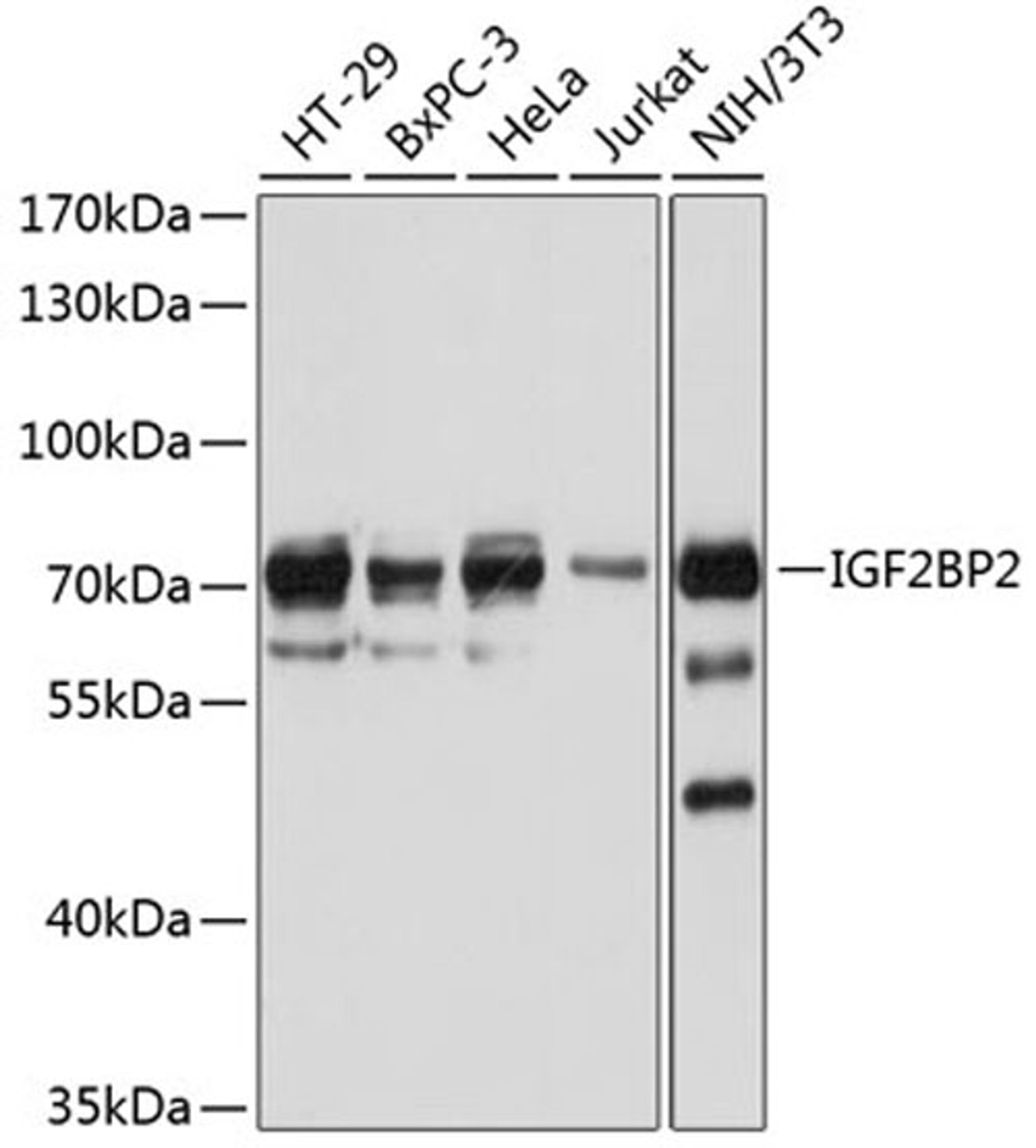 Western blot - IGF2BP2 antibody (A1774)