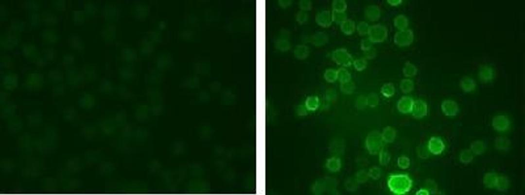 Immunohistochemistry: Kv3.1 [p Ser503] Antibody [NB300-279] - IHC staining of medial nucleus of the trapezoid body (MNTB) cells with the phospho-Ser503 Kv3.1 subunit antibody. The left panel shows control cells. The right panel shows cells that have been exposed to the protein kinase C activator PMA.