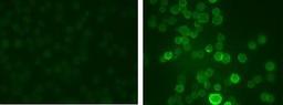 Immunohistochemistry: Kv3.1 [p Ser503] Antibody [NB300-279] - IHC staining of medial nucleus of the trapezoid body (MNTB) cells with the phospho-Ser503 Kv3.1 subunit antibody. The left panel shows control cells. The right panel shows cells that have been exposed to the protein kinase C activator PMA.