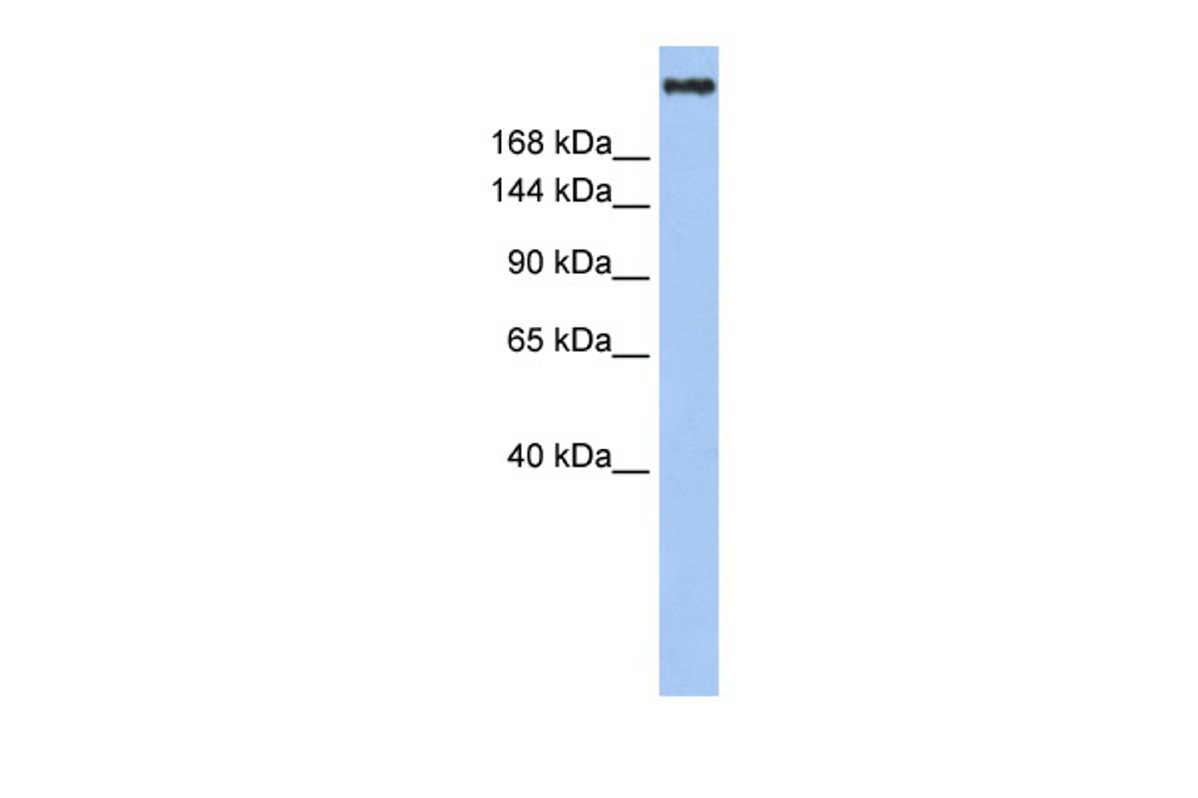 Antibody used in WB on Human Jurkat 1 ug/ml.