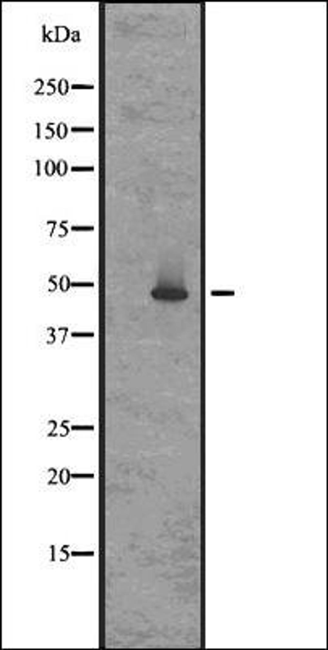 Western blot analysis of Rat brain lysates using GPR83/GPR72 antibody