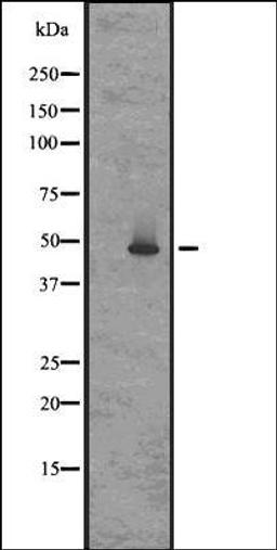 Western blot analysis of Rat brain lysates using GPR83/GPR72 antibody