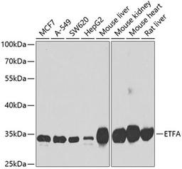 Western blot - ETFA antibody (A7670)