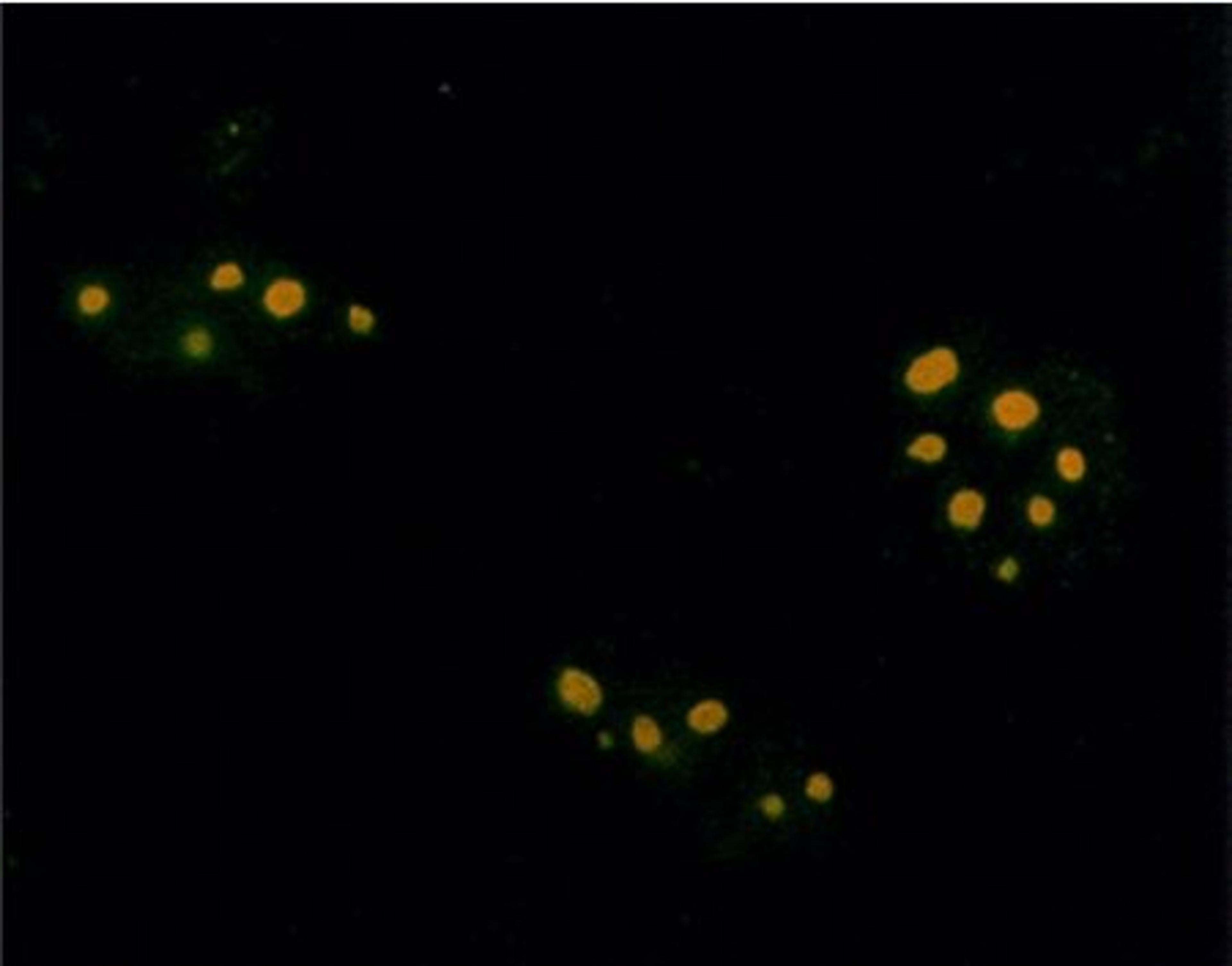 Immunofluorescence analysis of plasmids encoding isoprenylated protein and visualized using Farnesyl antibody