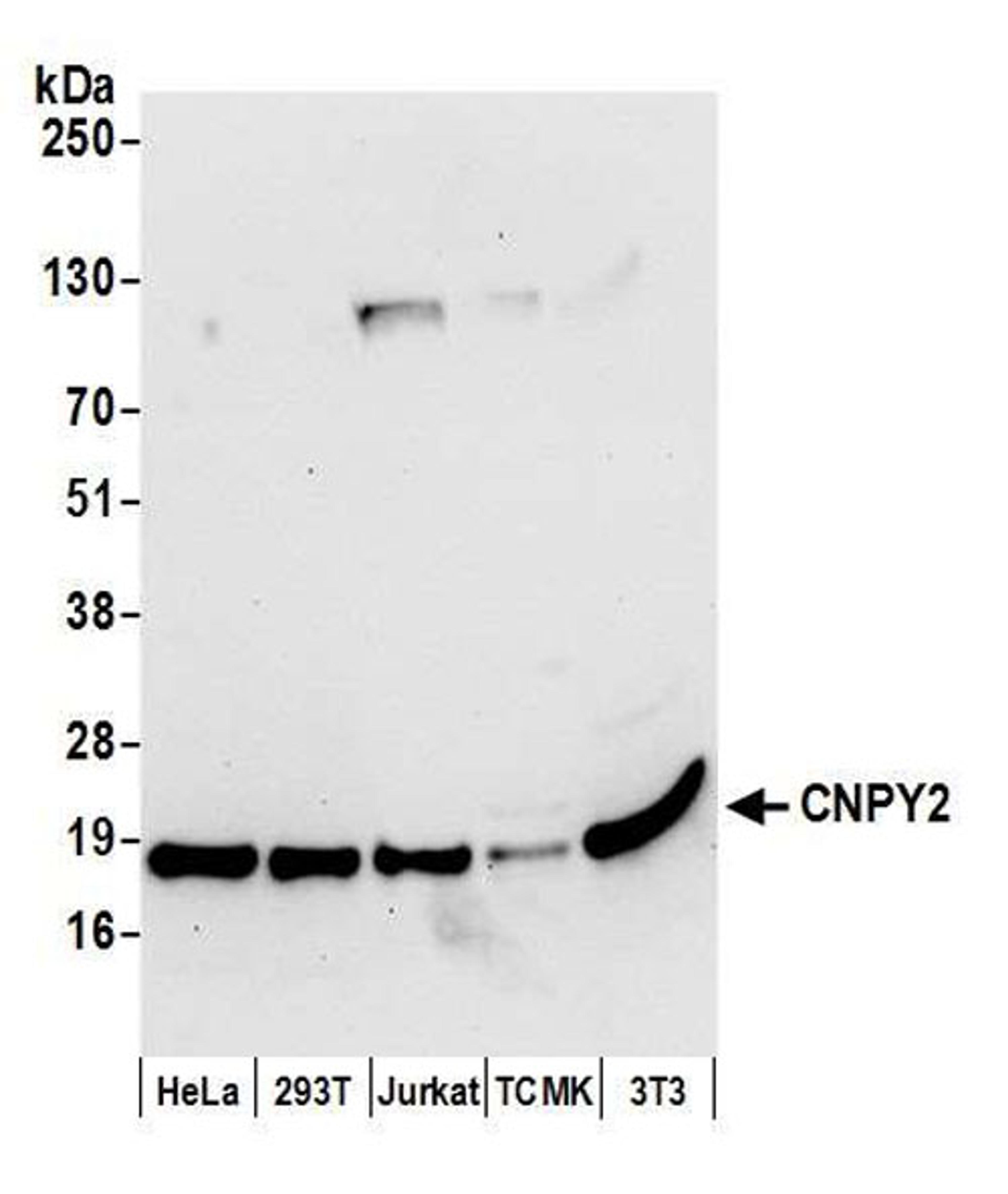 Detection of human and mouse CNPY2 by WB.