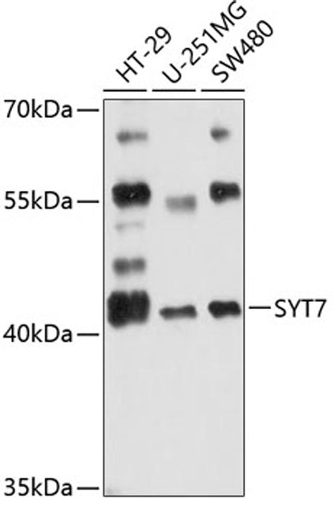 Western blot - SYT7 antibody (A12757)