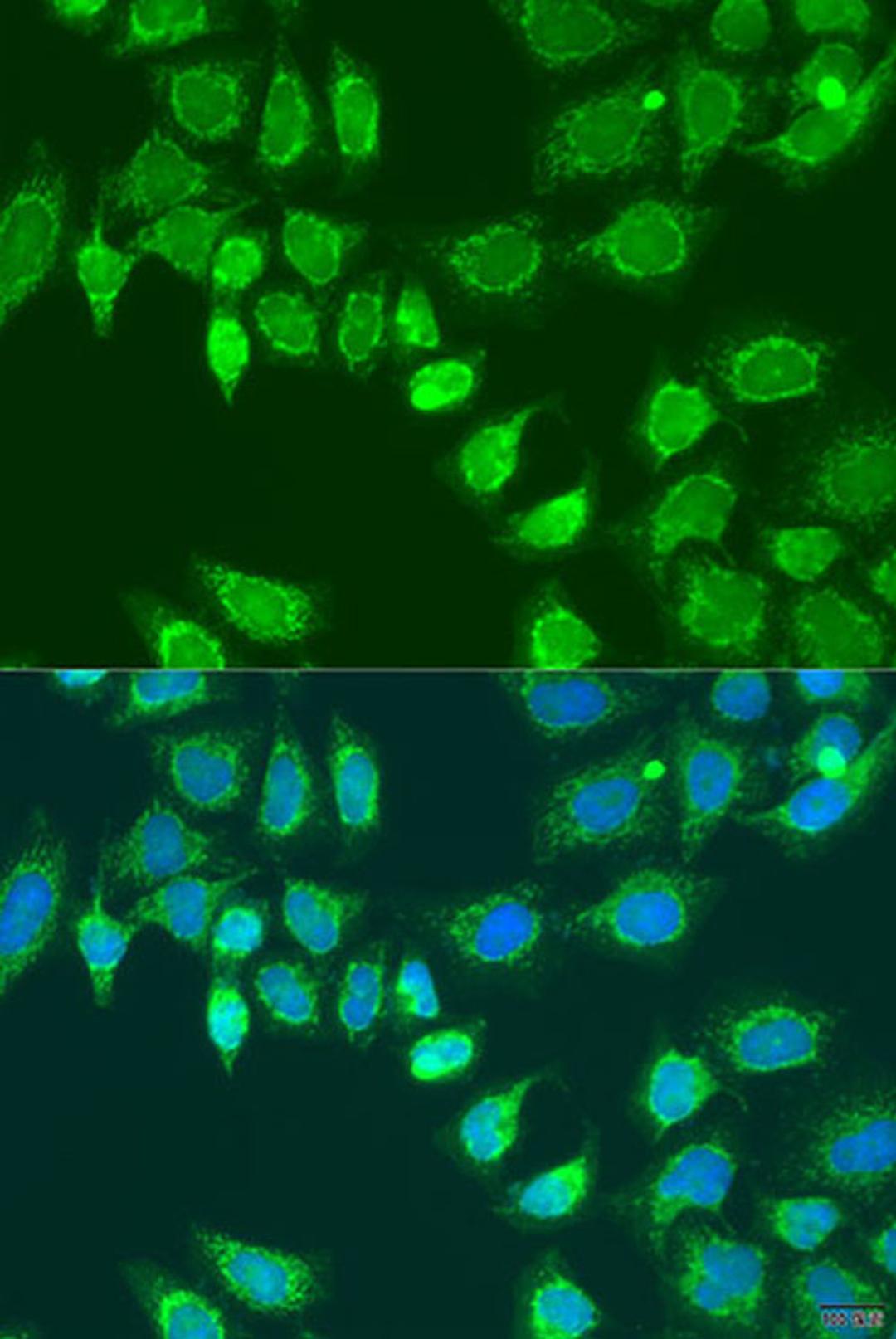 Immunofluorescence - L2HGDH antibody (A15192)