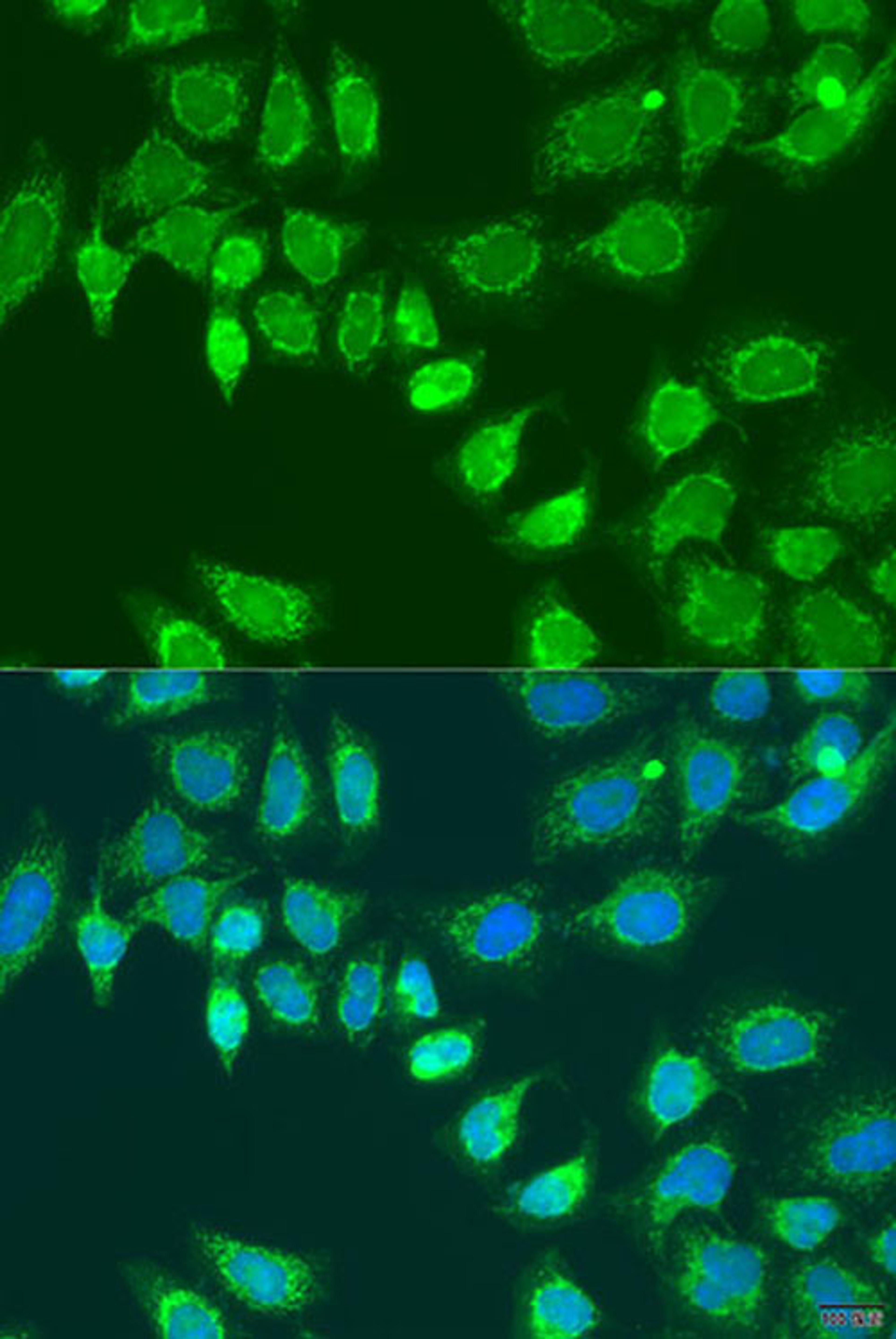 Immunofluorescence - L2HGDH antibody (A15192)