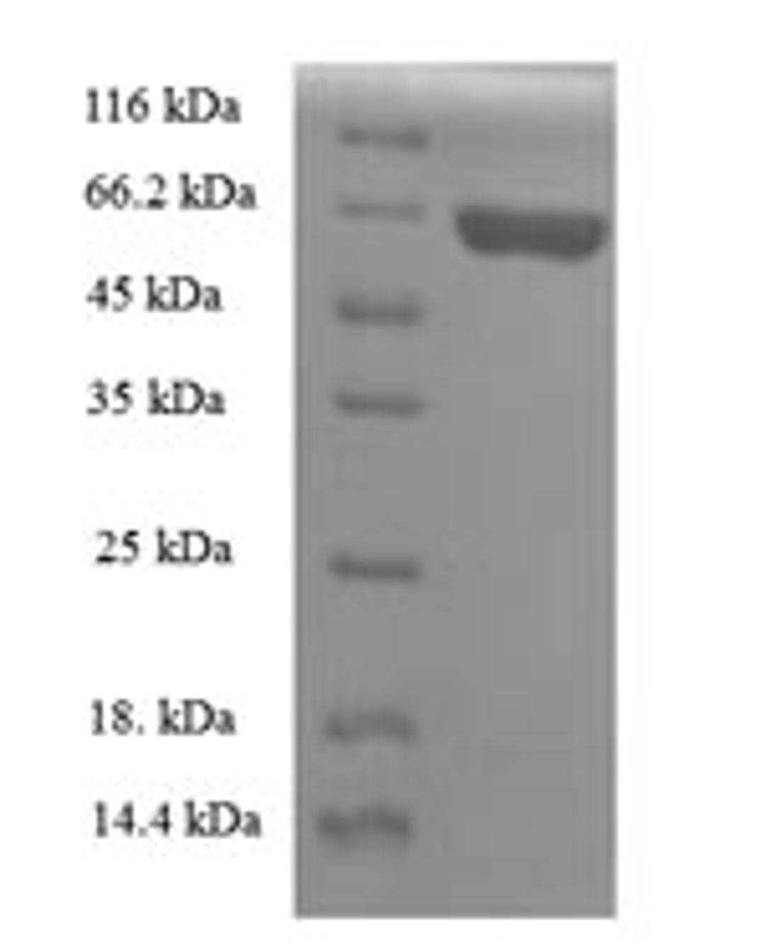 (Tris-Glycine gel) Discontinuous SDS-PAGE (reduced) with 5% enrichment gel and 15% separation gel.