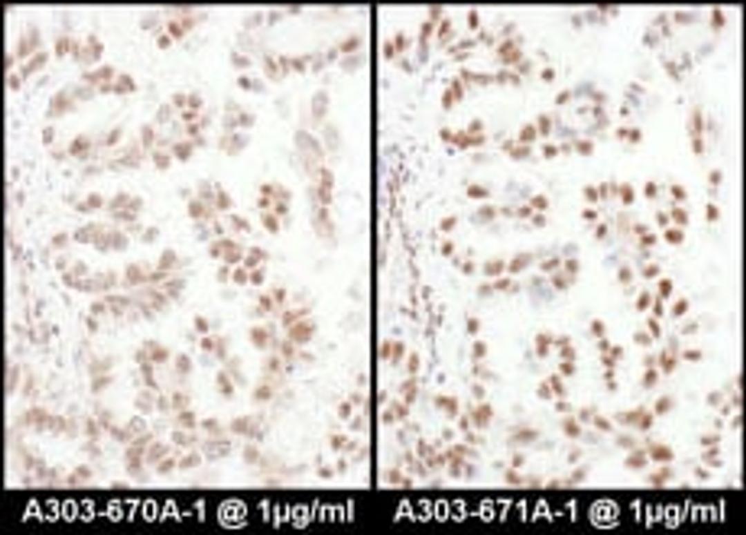 Detection of human SRp75 by immunohistochemistry.