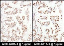 Detection of human SRp75 by immunohistochemistry.