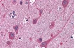 Immunohistochemistry-Paraffin: STAP2 Antibody [NB300-987] - (3.8ug/ml) staining of paraffin embedded Human Cortex. Steamed antigen retrieval with citrate buffer pH 6, AP-staining.