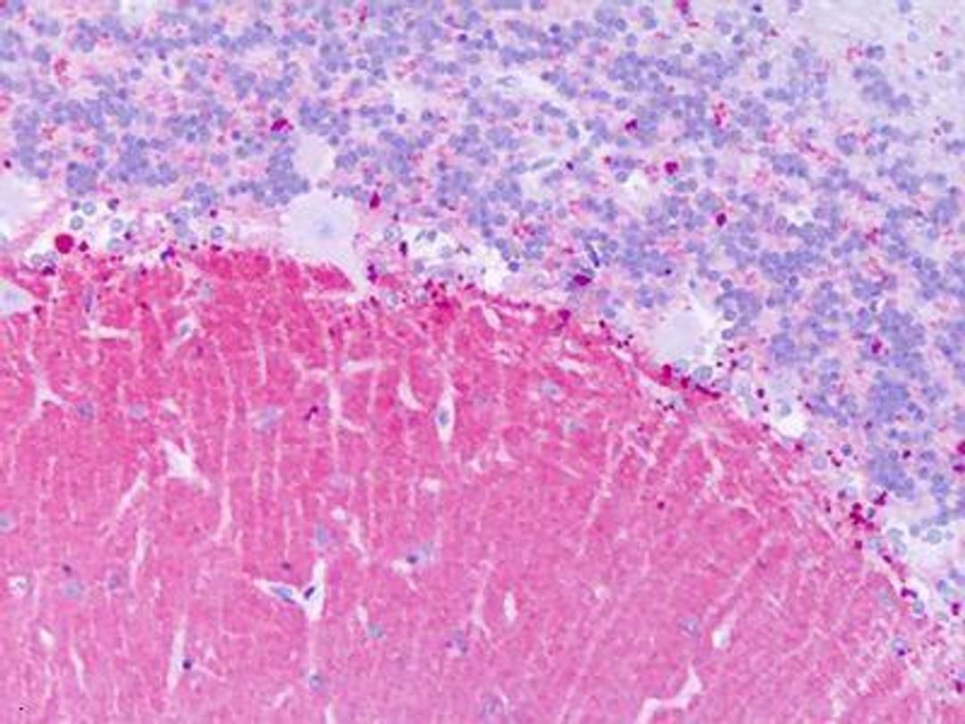 Immunohistochemistry-Paraffin: KiSS1R/GPR54 Antibody [NLS1926] - Human, Brain, Cerebellum:  Formalin-Fixed Paraffin-Embedded (FFPE)