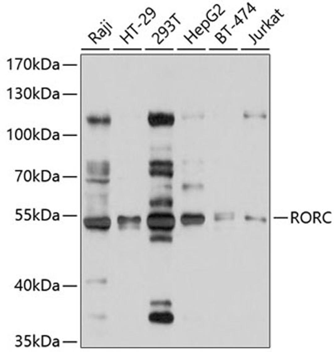 Western blot - RORC antibody (A10240)