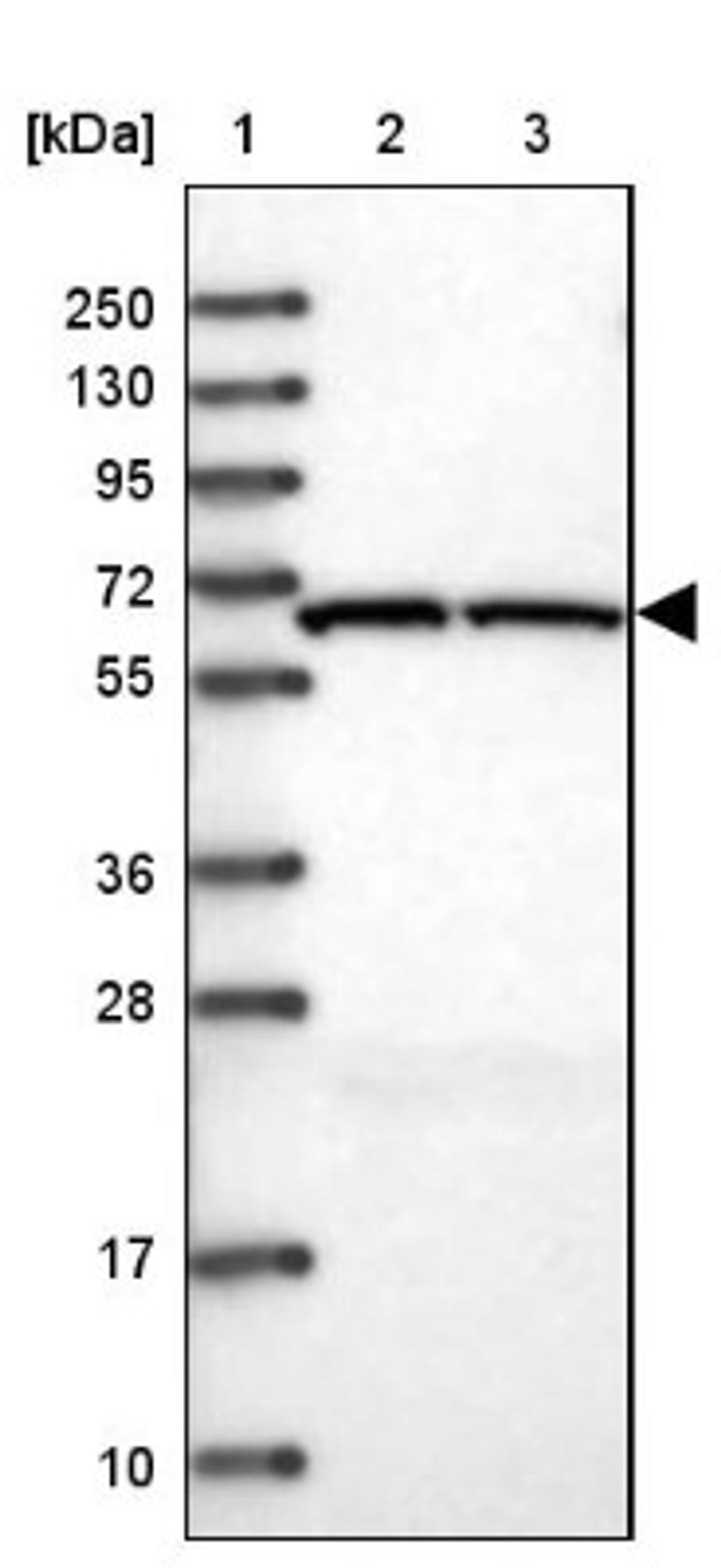 Western Blot: ACAD9 Antibody [NBP1-82749] - Lane 1: Marker [kDa] 250, 130, 95, 72, 55, 36, 28, 17, 10<br/>Lane 2: Human cell line RT-4<br/>Lane 3: Human cell line U-251MG sp