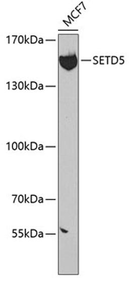 Western blot - SETD5 antibody (A7304)