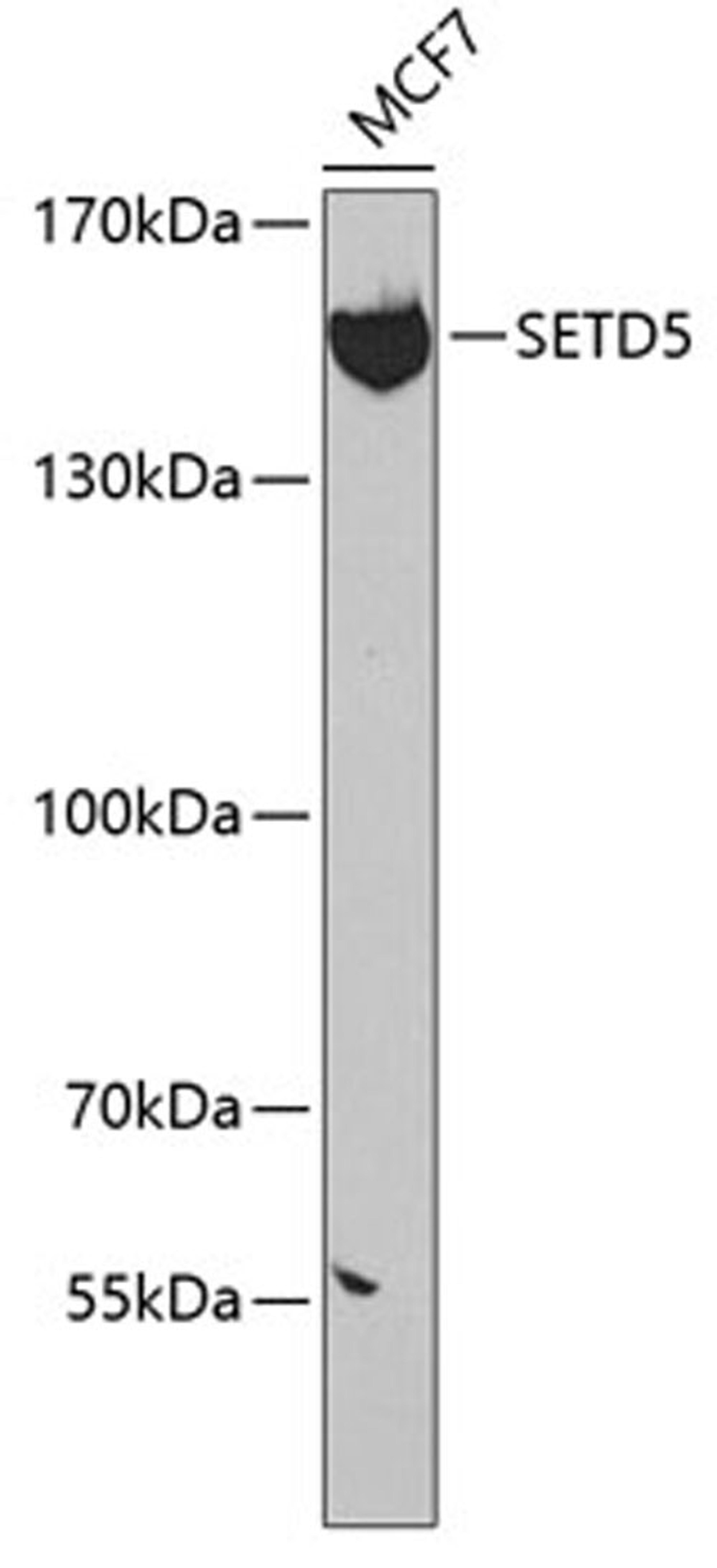 Western blot - SETD5 antibody (A7304)