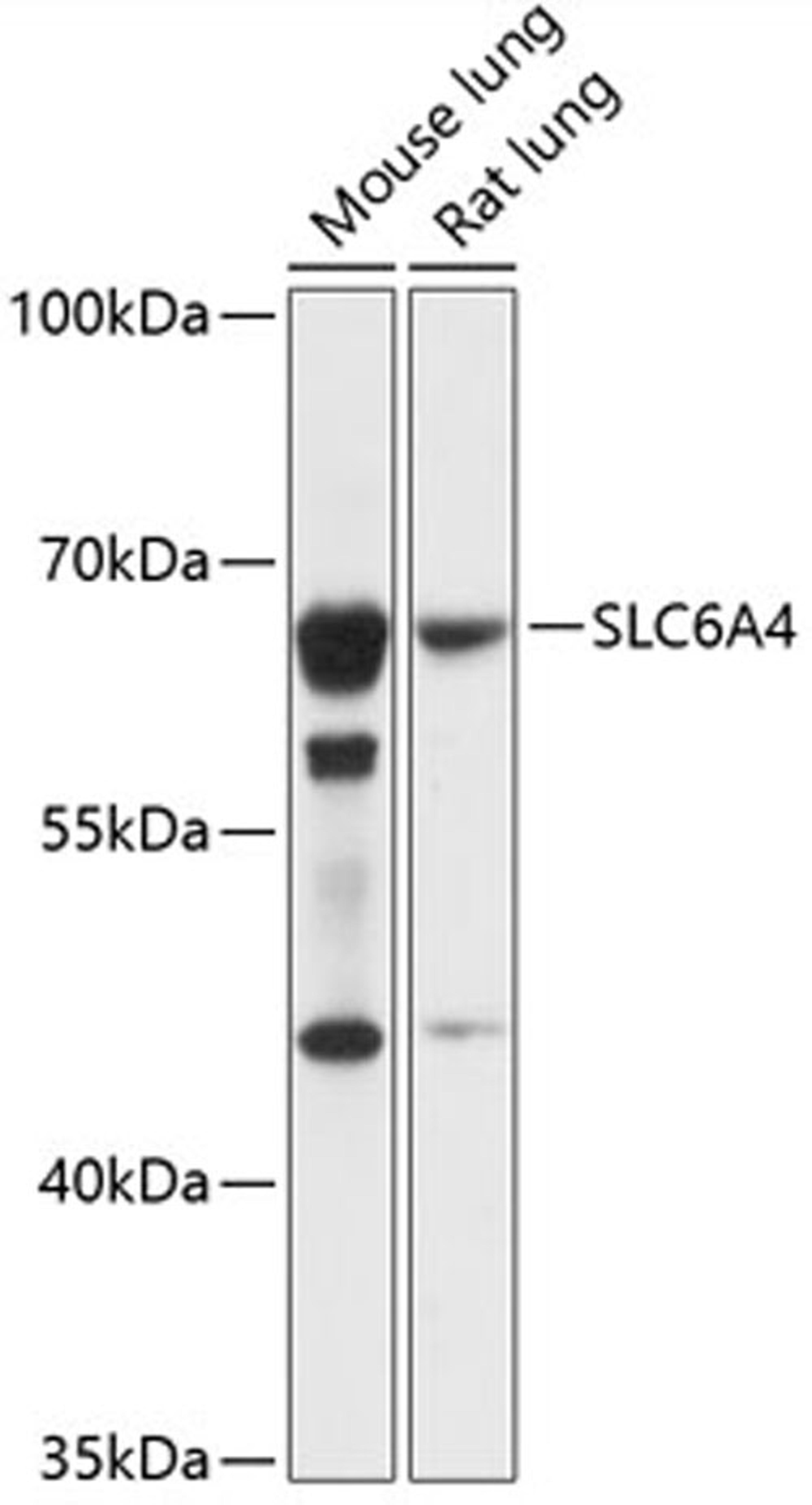 Western blot - SLC6A4 antibody (A14782)